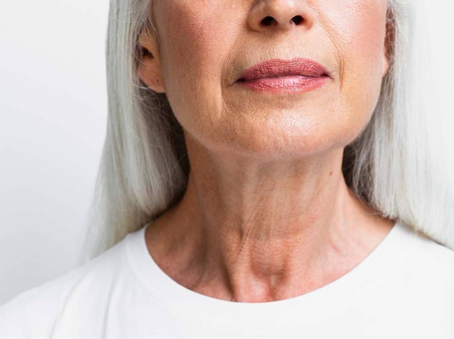 Líneas de marioneta