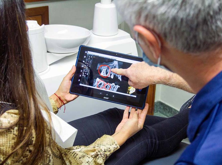 A qué edad salen las muelas del juicio