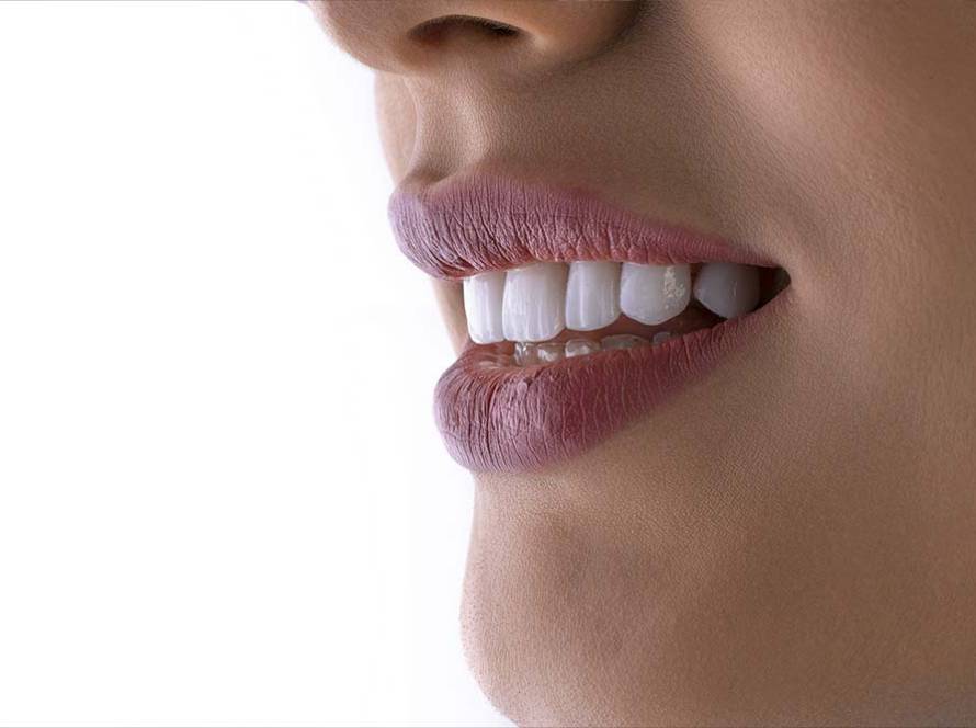 Cómo conseguir una sonrisa perfecta