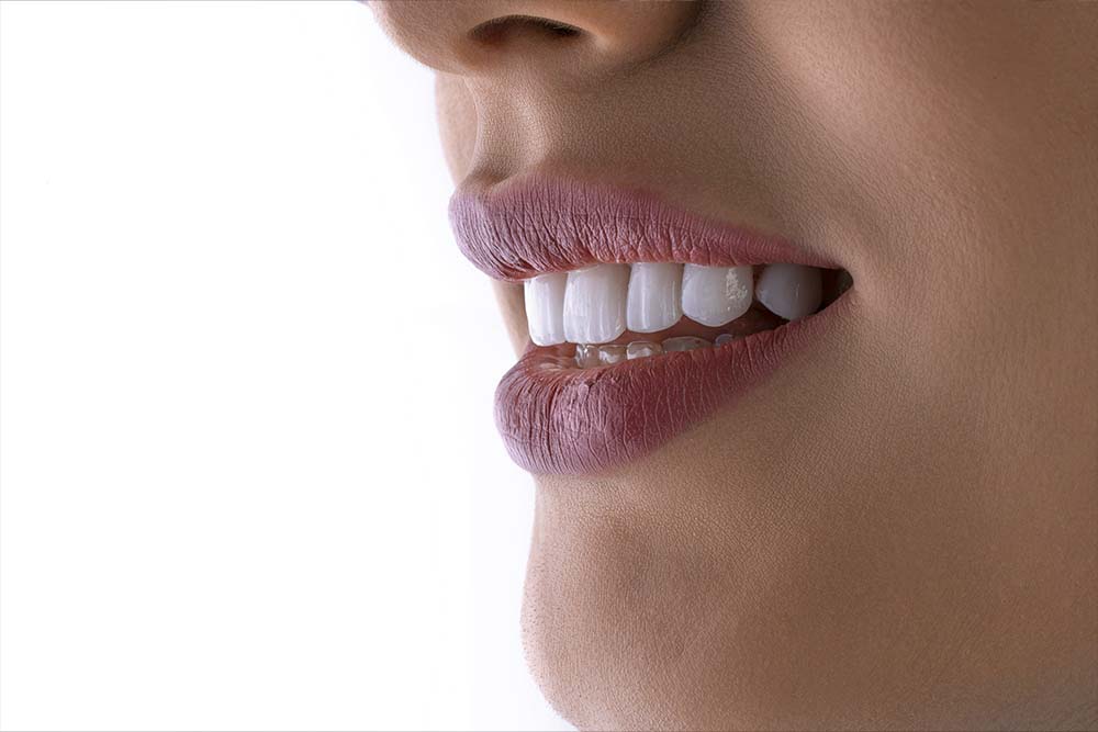 Cómo conseguir una sonrisa perfecta