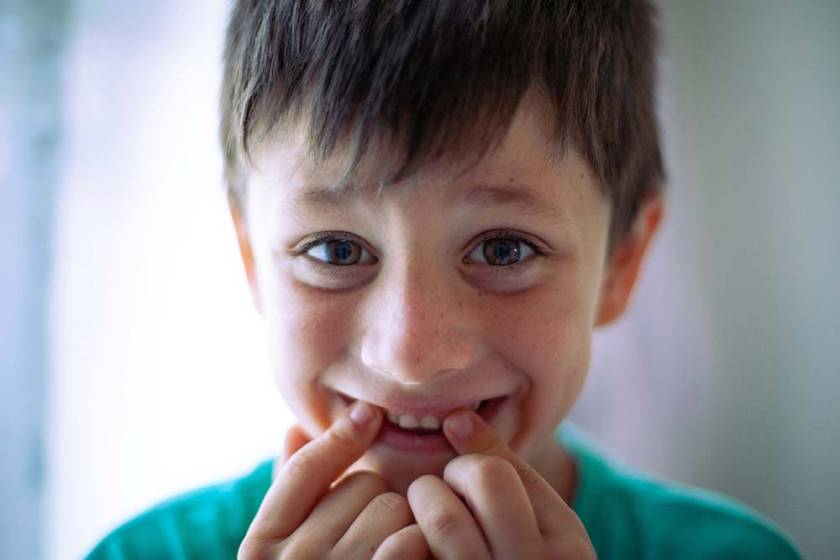 DIENTES DE LECHE