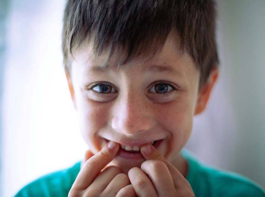 DIENTES DE LECHE
