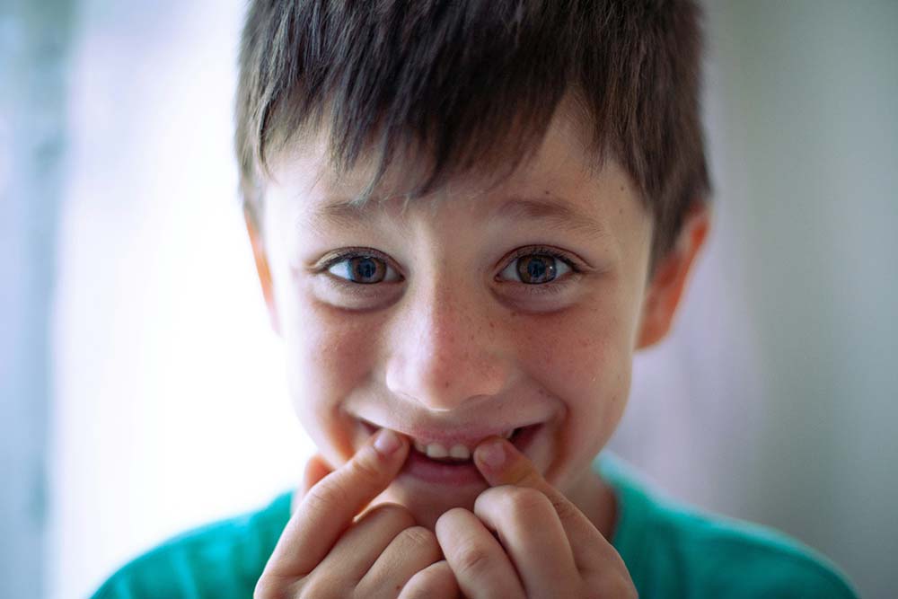 DIENTES DE LECHE